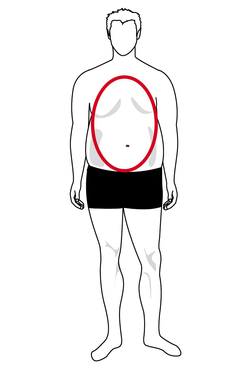 The oval body type